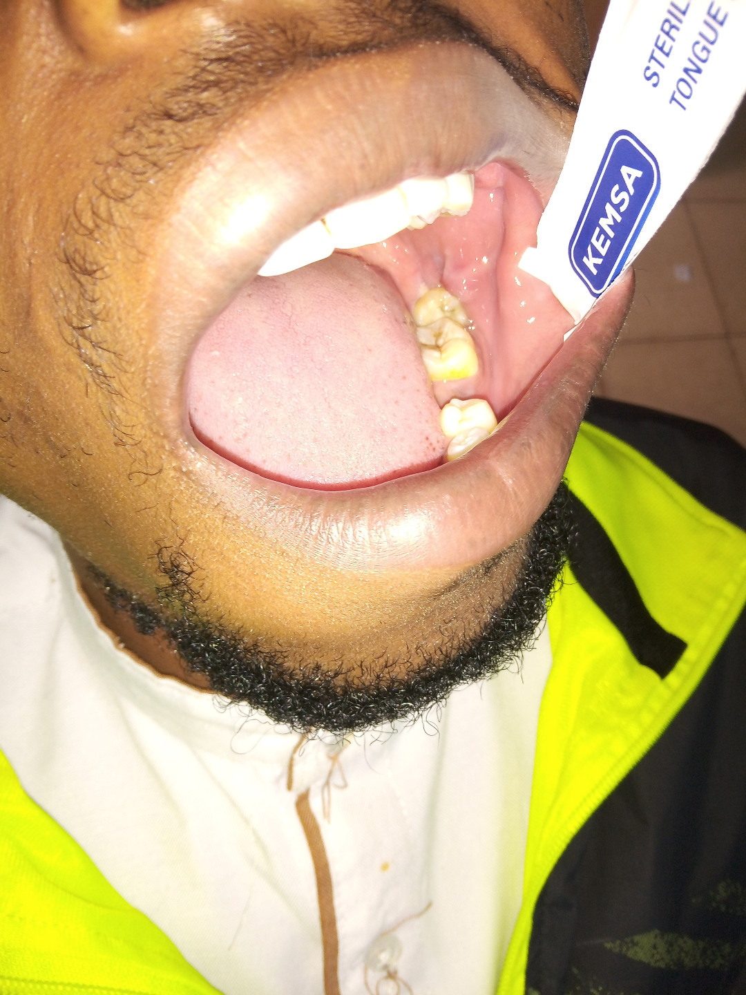 open mouth